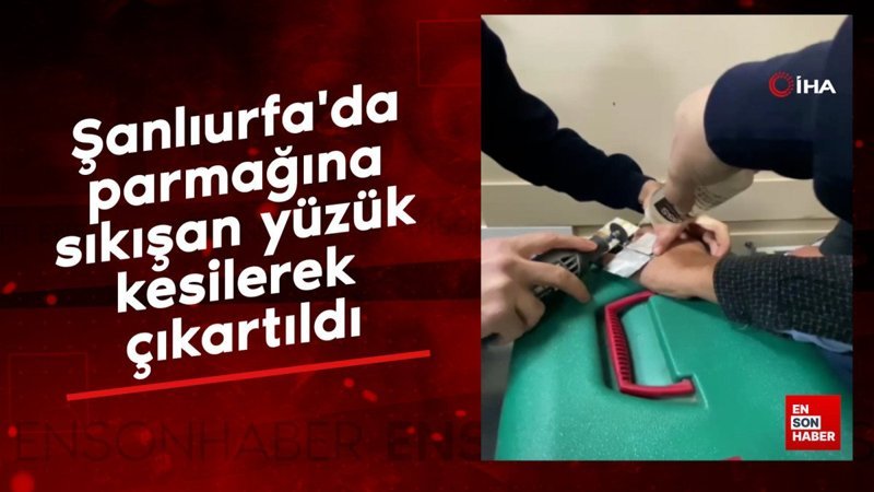 sanliurfada parmagina sikisan yuzuk kesilerek cikartildi vJyTKy2s