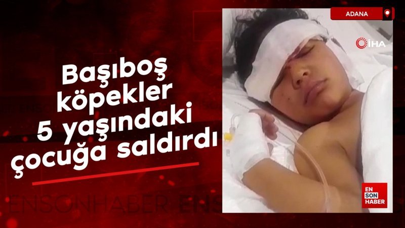 adanada basibos kopekler 5 yasindaki cocuga saldirdi