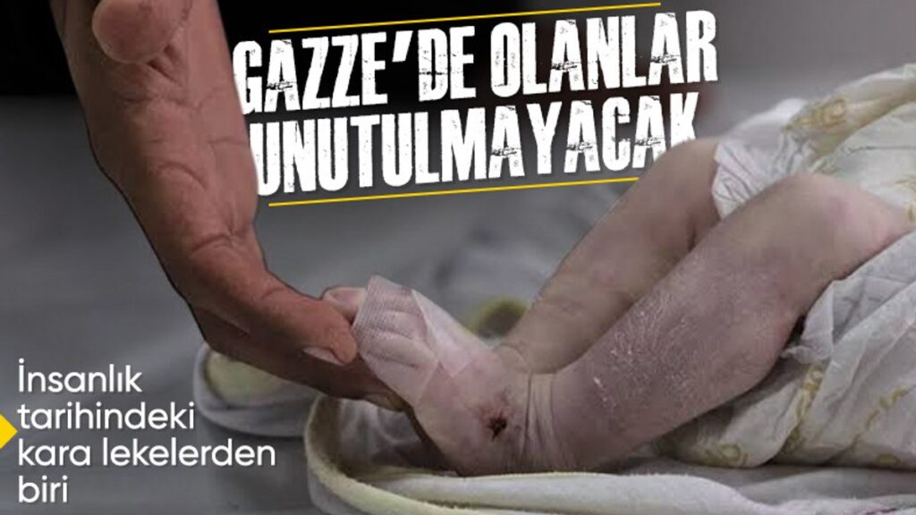 gazzede 470 gunun bilancosu onbinlerce can kaybi ve yikilan sehir WfXTSK8g