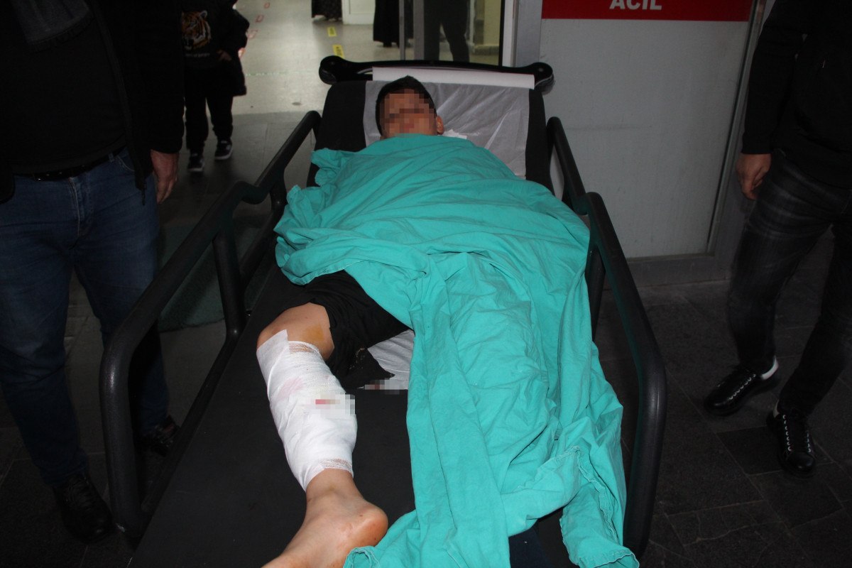 batmanda 12 yasindaki cocuk basibos kopeklerin saldirisina ugradi 0 nlBQtJHu