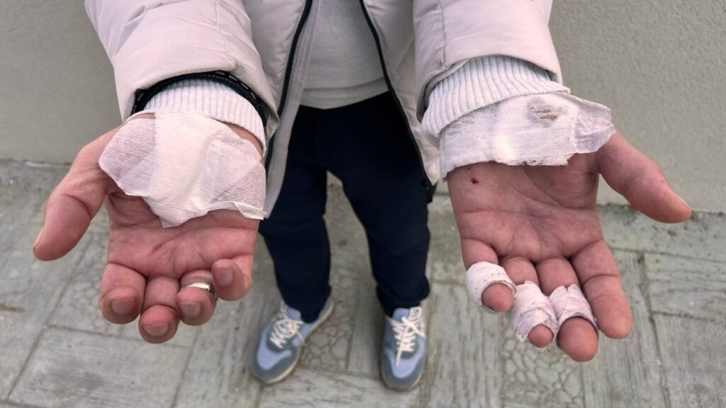 esenyurtta sokakta beslenen kopekler yoldan gecenlere saldirdi CDuAg6nG