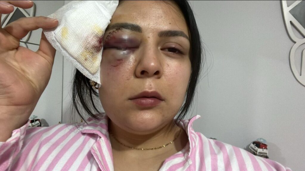 kahramanmarasta yururken saldiriya ugrayan genc kiz konustu Q2nxC1qZ