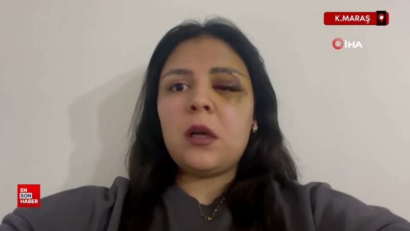 kahramanmarasta yururken saldiriya ugrayan genc kiz konustu V9ynz1d4