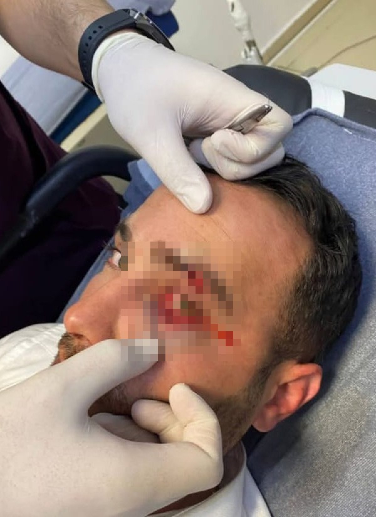 aksarayda imam kendisine saldiran komsusunu bicakladi 0 bZyeT3v8