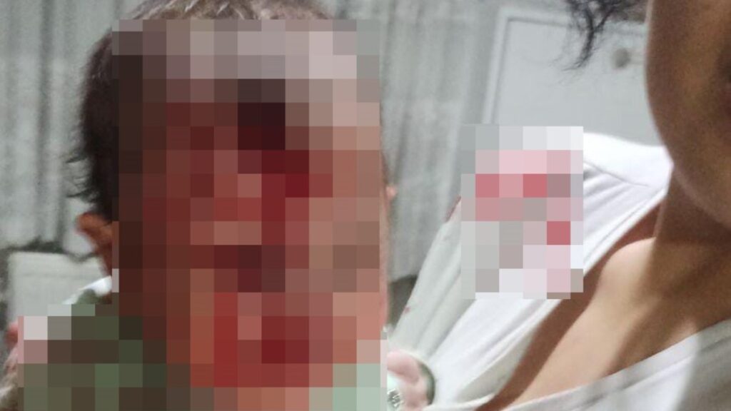 ankarada 4 aylik bebegini cam sehpaya firlatip yaraladi lEfVZdRs