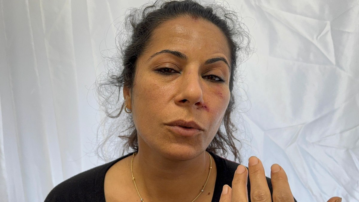 Antalya'da otobüs kazasında eşini kaybetti: Son sözü nefes alamıyorum oldu 1 antalyada otobus kazasinda esini kaybetti son sozu nefes alamiyorum oldu 0 TIEwPi26