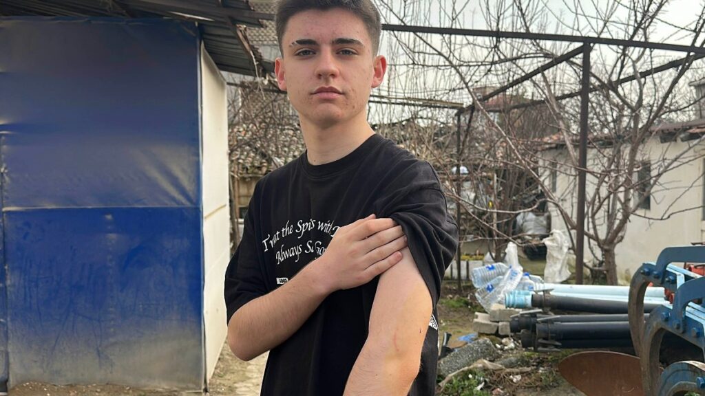 edirnede okul yolunda kopek saldirisi 3tUXwjIQ