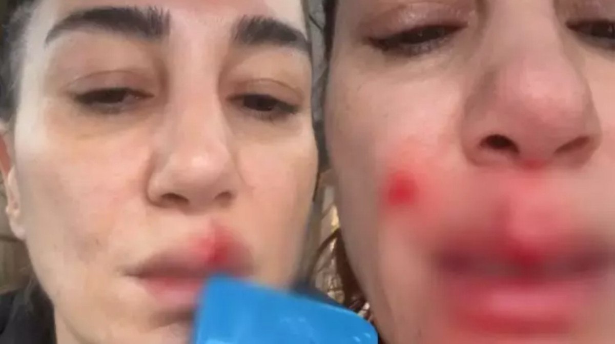 ev kazasi geciren nadide sultan hastanelik oldu 0 vCVFUycj