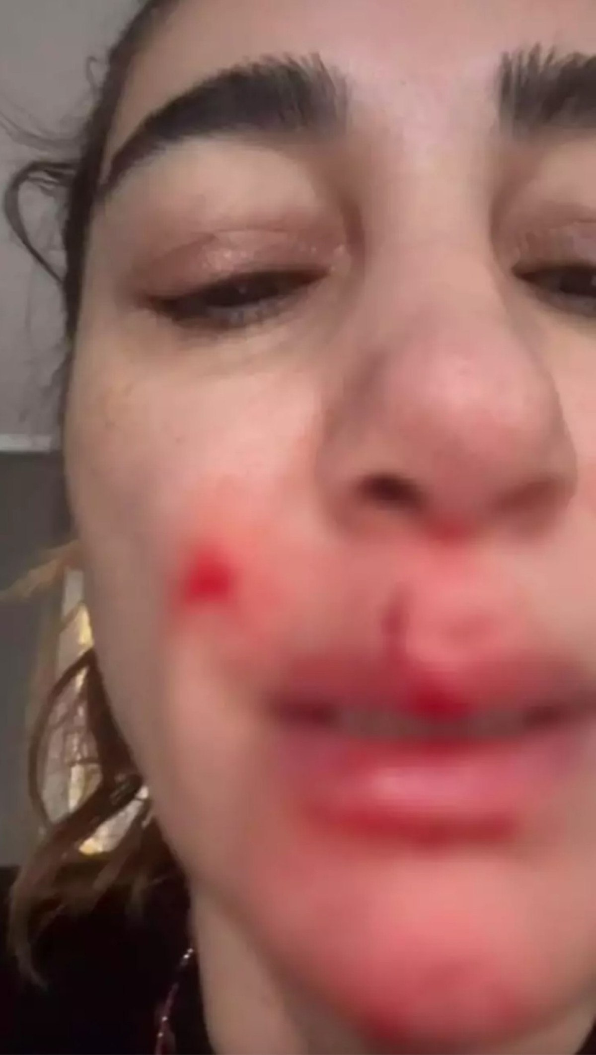 ev kazasi geciren nadide sultan hastanelik oldu 1 Qt3tEFsu