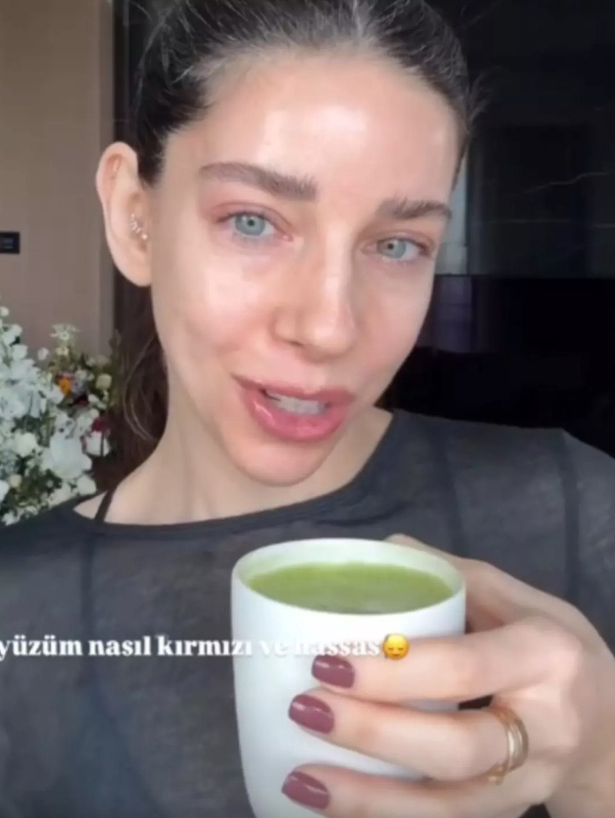 kalp ameliyati olmustu elvin levinlerin doktoru matcha uyarisindan bulundu 0 nUGhcYp8