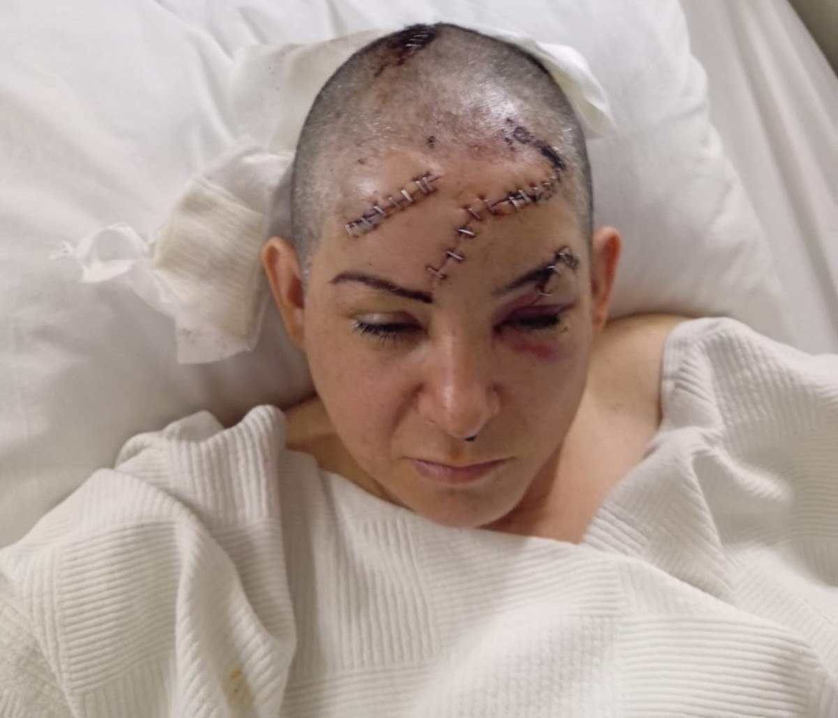 nevsehirde esi satirla saldirdi olecegimi dusundum 1 FUuzkvt8