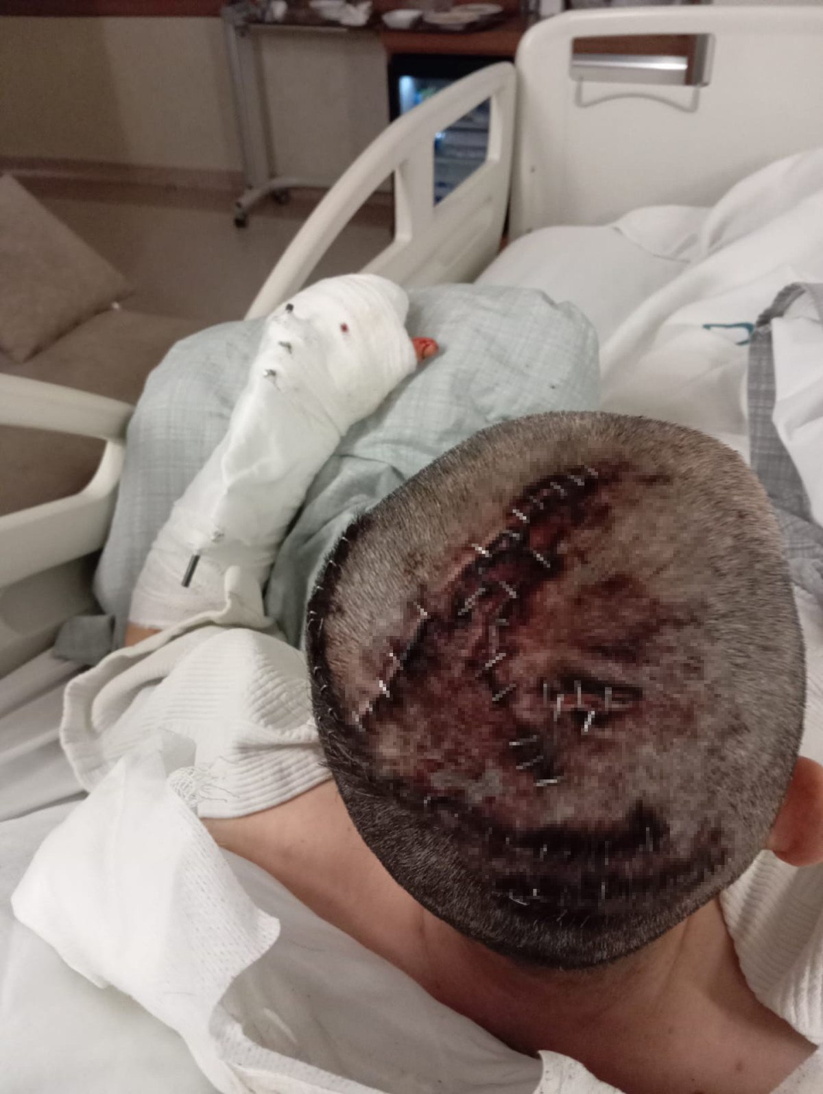 nevsehirde esi satirla saldirdi olecegimi dusundum 6 tgDf6nYc