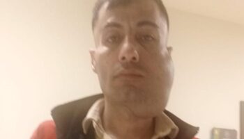 18 santimetrelik tumorunden kurtuldu artik yeni bir yuzu var hnva1lz8