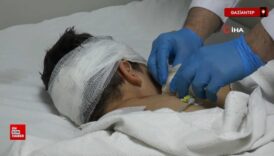 adiyamanda 45 yasindaki cocuk 5 sokak kopeginin saldirisinda agir yaralandi rnWPV36Z