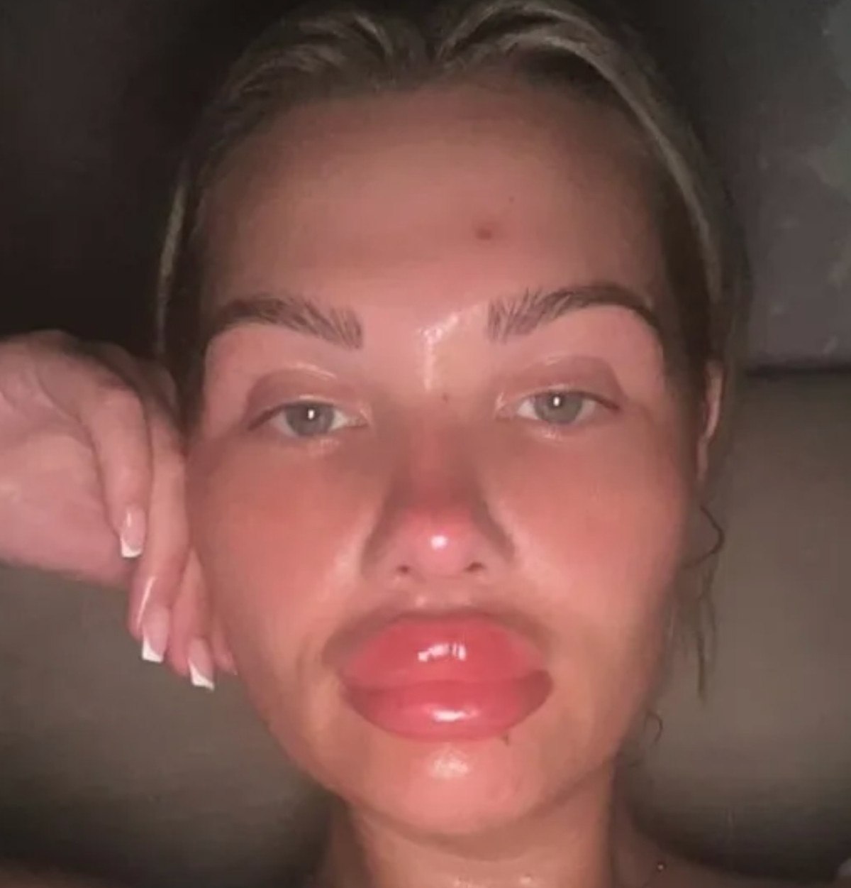 bulgaristanda sahte doktora dolgu yaptiran 15 kisi zehirlendi 0 hTm1VO88