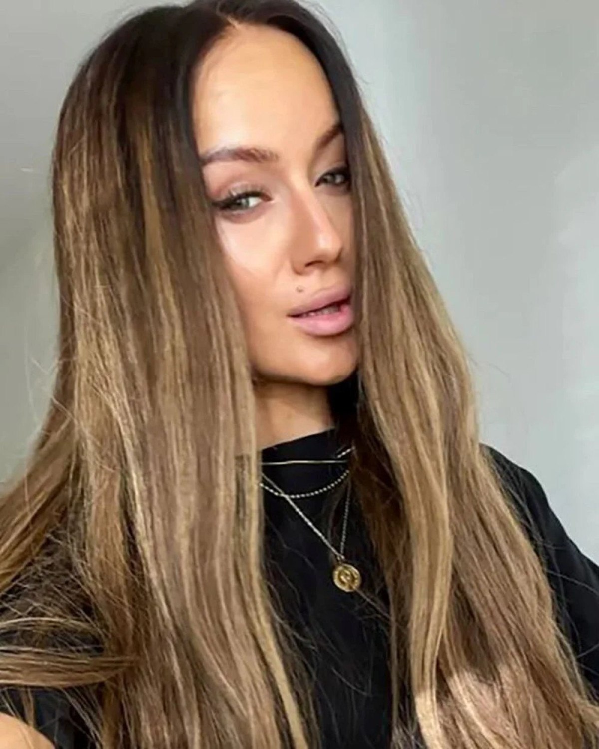 cekyada gogus buyutme ameliyatina girdi saclari dokuldu 0 sySe3q3v