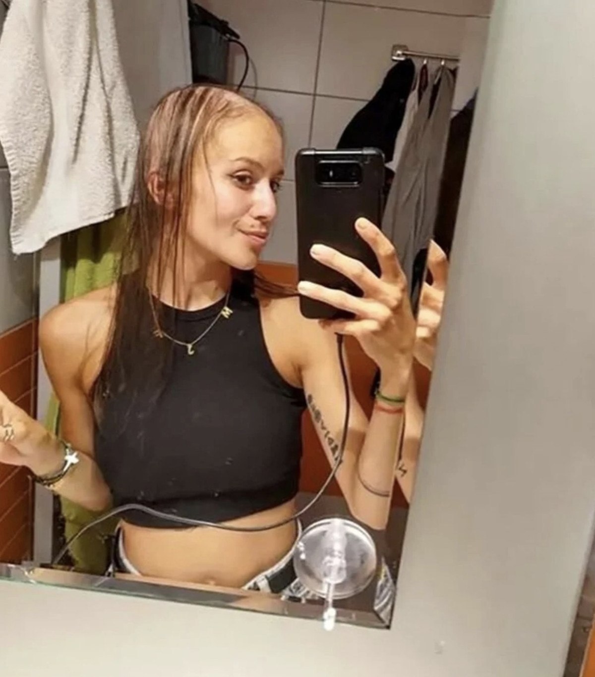 cekyada gogus buyutme ameliyatina girdi saclari dokuldu 1 C47tAfrf