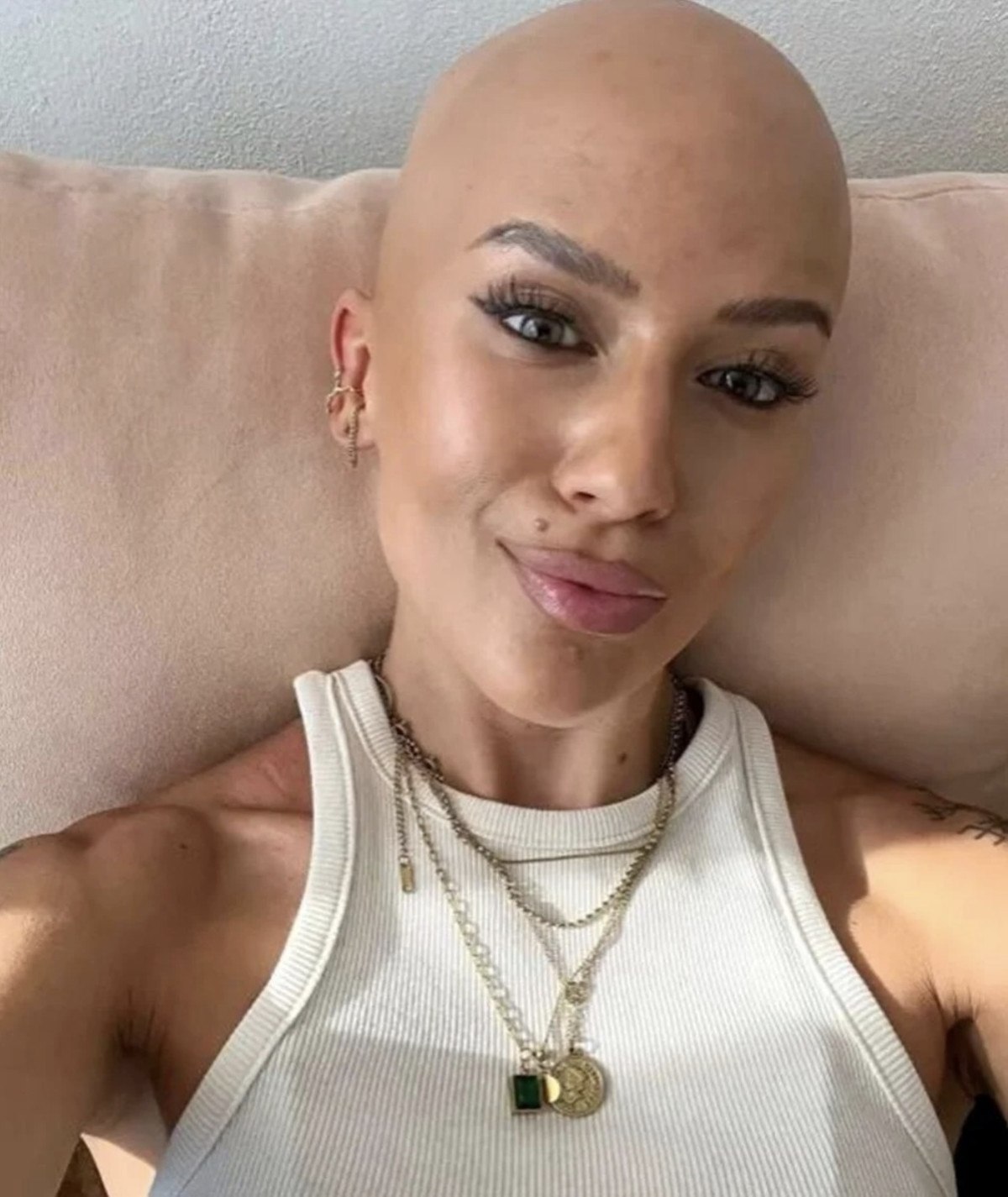 cekyada gogus buyutme ameliyatina girdi saclari dokuldu 2 UYXN4Q72