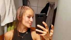 cekyada gogus buyutme ameliyatina girdi saclari dokuldu 6t48bcsW