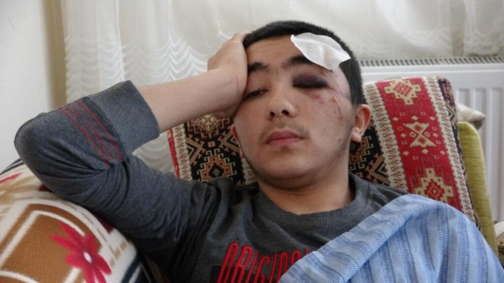 ispartada basibos kopeklerden kacan cocuk olumden dondu ZwxJqXWl