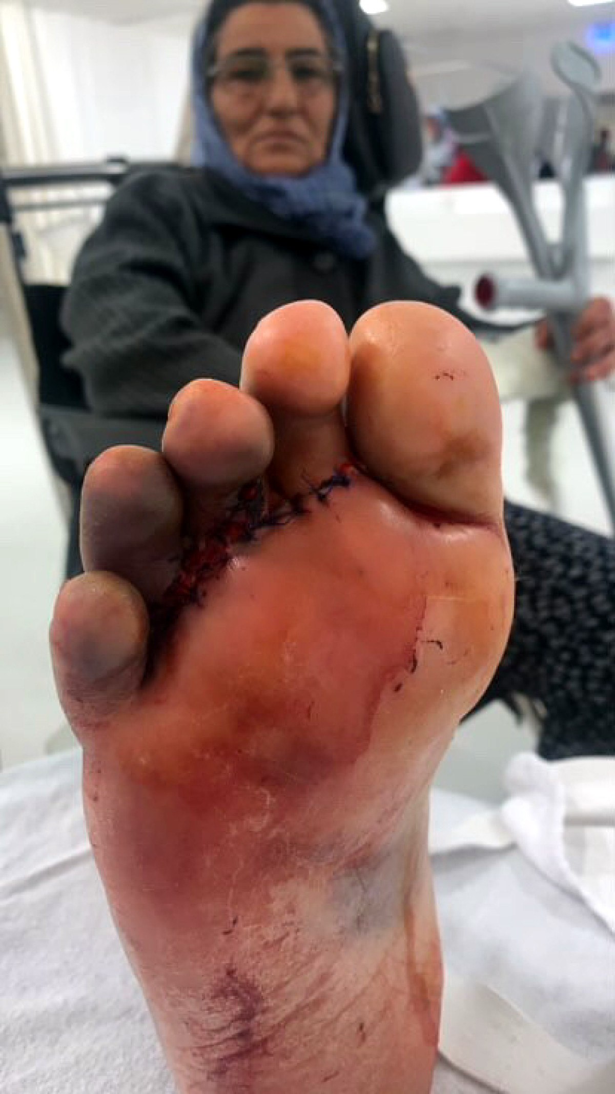 istanbulda karsidan karsiya gecerken ayagi ezildi 0 f3SqeFGH