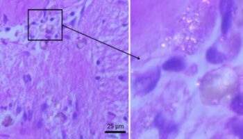 korkutan arastirma mikroplastikler artik insan beyninde birikiyor QjEZuFyg