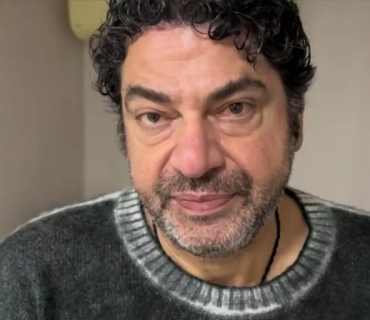 organ nakli olmustu hakan tasiyan botoks yaptirdi 0 rYUJjDPN