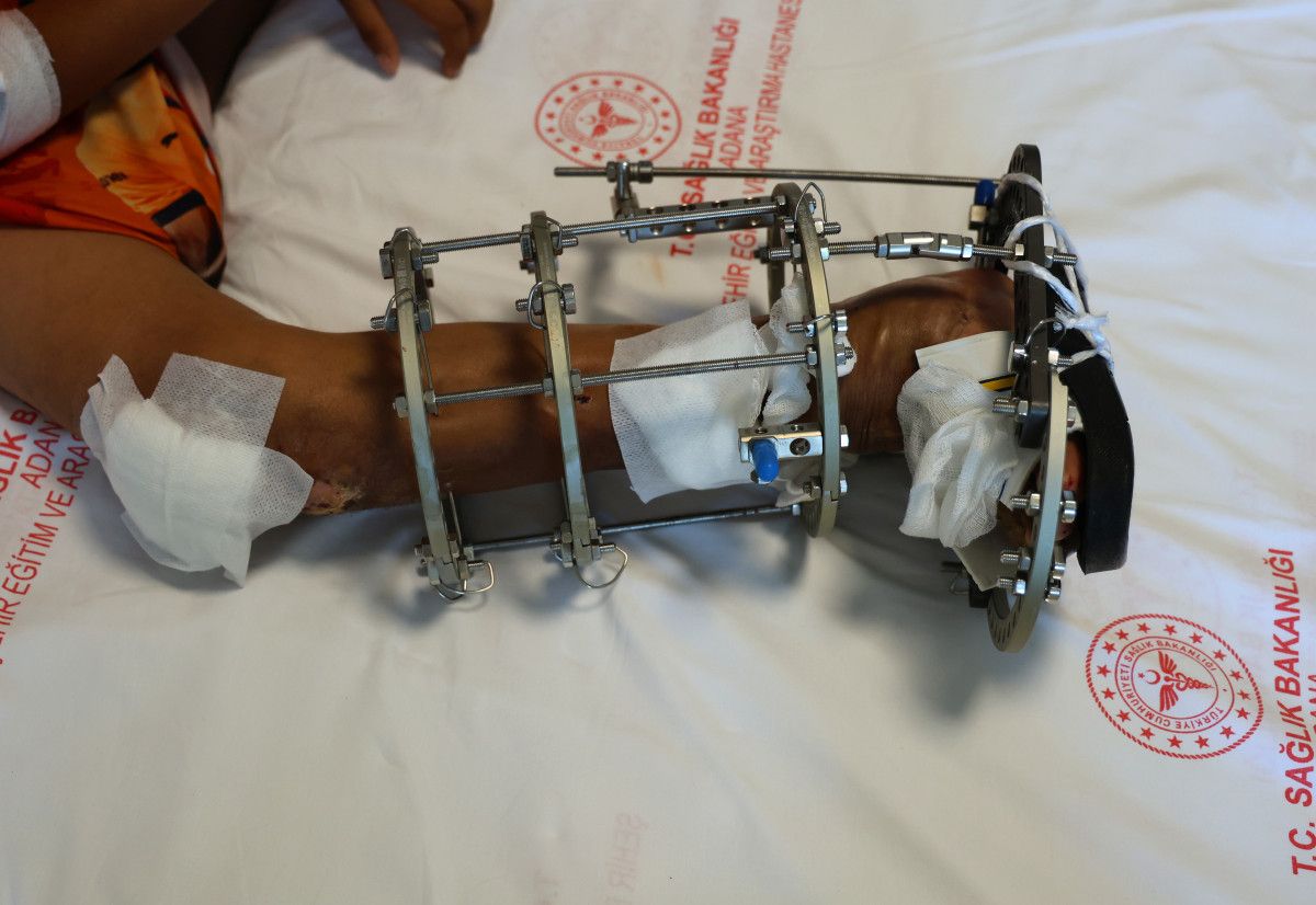 Adana'da hayatı kaykay üzerinde geçen Serdal artık yürüyor 4 adanada hayati kaykay uzerinde gecen serdal artik yuruyor 3 u9kDtzEM