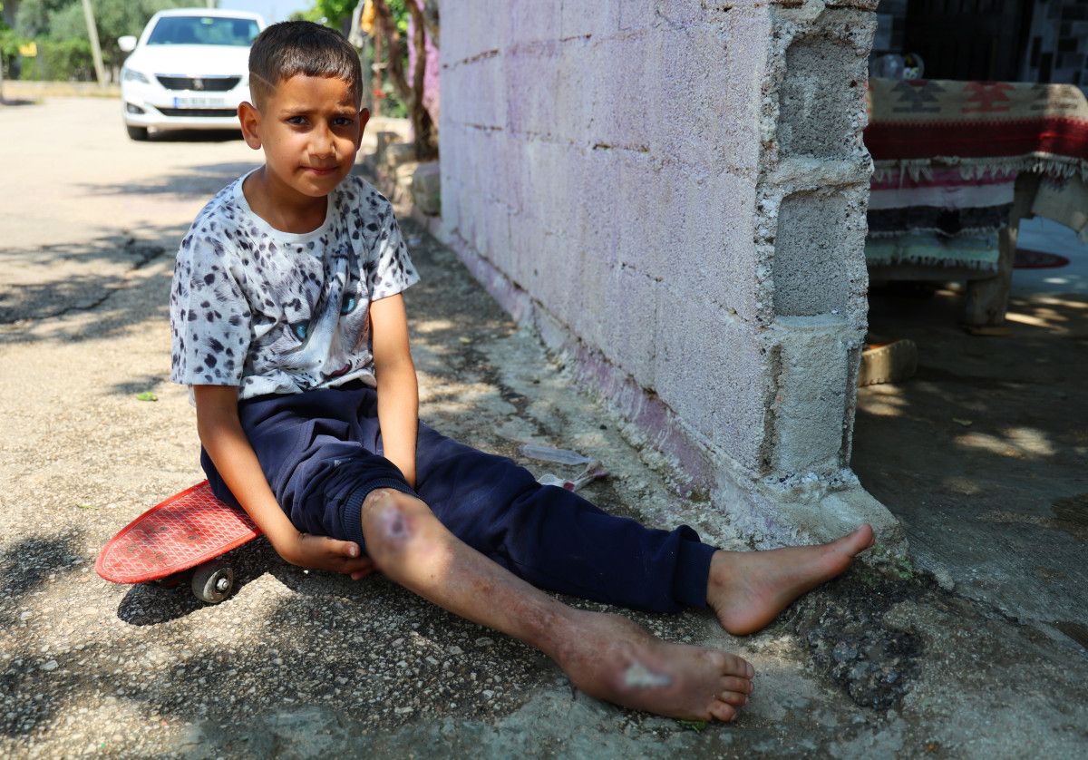 Adana'da hayatı kaykay üzerinde geçen Serdal artık yürüyor 5 adanada hayati kaykay uzerinde gecen serdal artik yuruyor 4 rjUfV2Wy