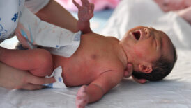 bebeklerde gaz sancisini azaltan yontemler 6wbbabSv