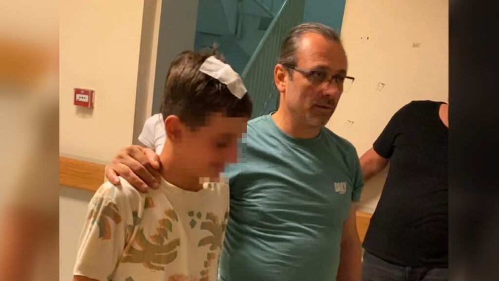 bursada komsusu sokakta oynayan cocugun basina sise atti 4i1FKlwB