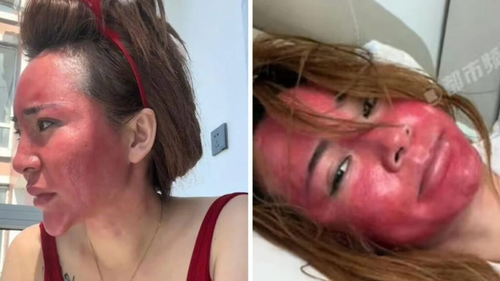 cinde yillarca makyajini silmeden uyuyan kadin sagligindan oldu P2V1IlHt