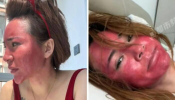 cinde yillarca makyajini silmeden uyuyan kadin sagligindan oldu P2V1IlHt