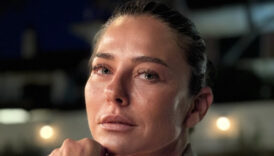 ece uslu tatilde hastanelik oldu 16 dikis atildi ryEaQuTM