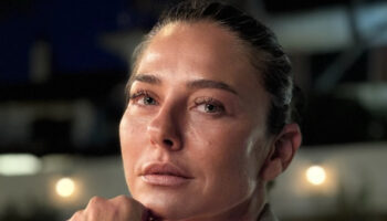 ece uslu tatilde hastanelik oldu 16 dikis atildi ryEaQuTM