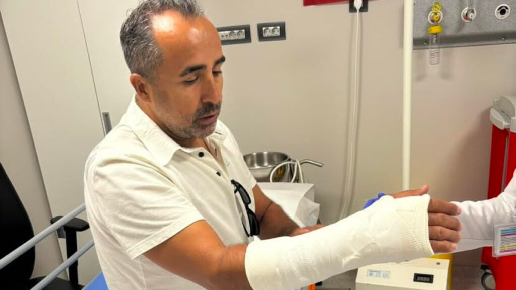 ernest mucinin sutu kameramana denk geldi kolu kirildi 8iKX1SjN