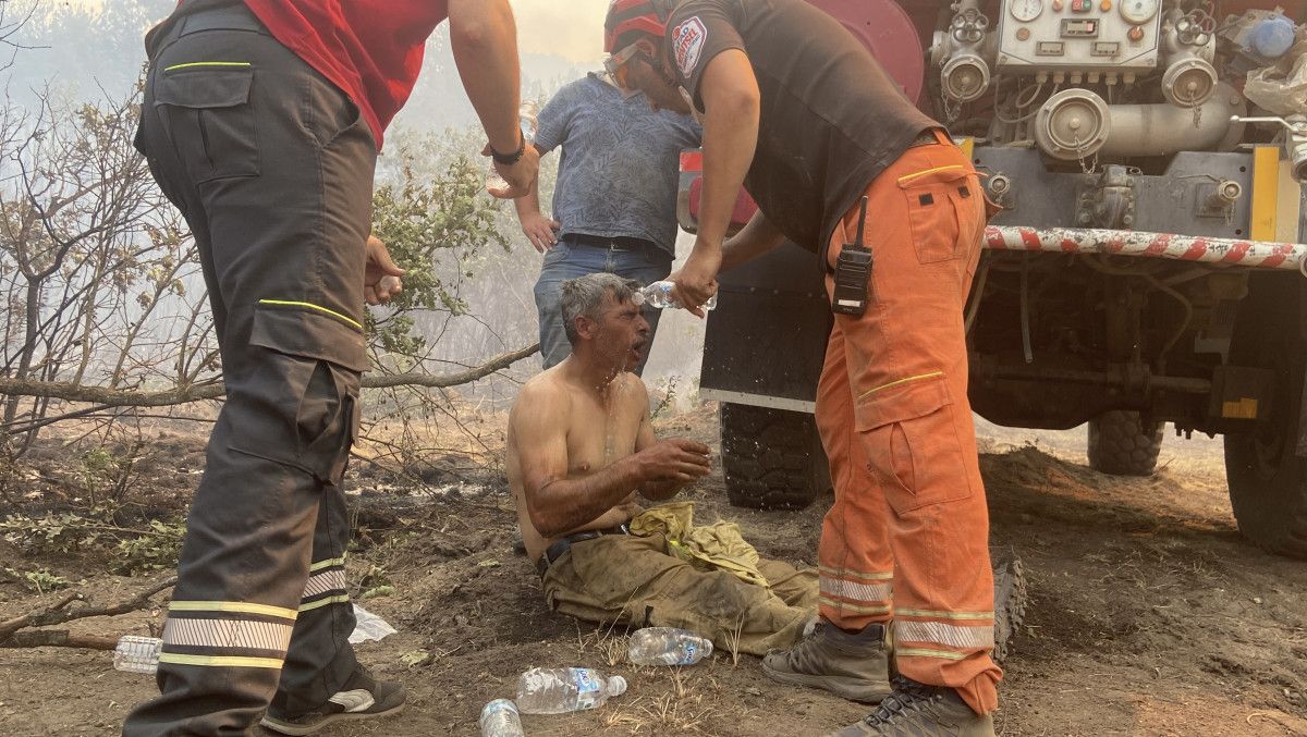 eskisehirdeki orman yanginina mudahale ederken agir yaralanan esini paylasti 0 cnZcGfJt