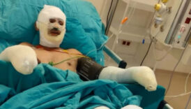 eskisehirdeki orman yanginina mudahale ederken agir yaralanan esini paylasti MkJlCOLZ