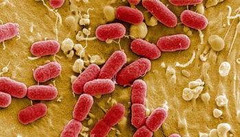 et yiyen bakteri abdde can almaya devam ediyor mcNs1Ang