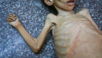 gazzede 147 kisi acliktan oldu eCP2z6vF