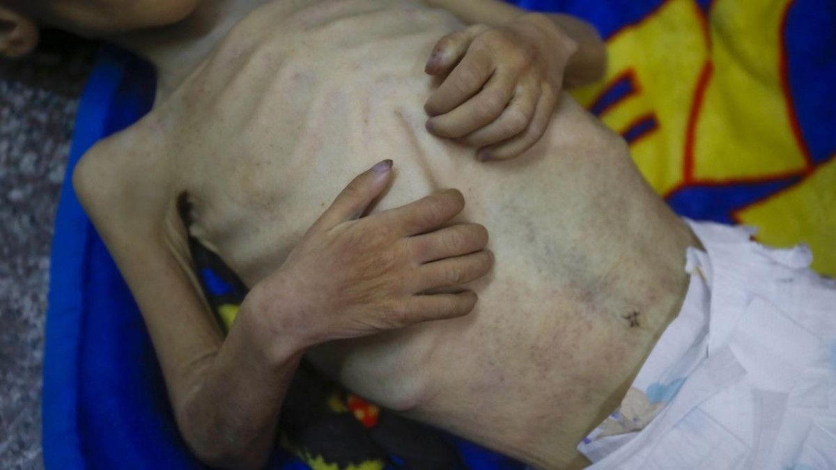 gazzede aclik suruyor bm son detaylari paylasti 1 JINdLIyQ