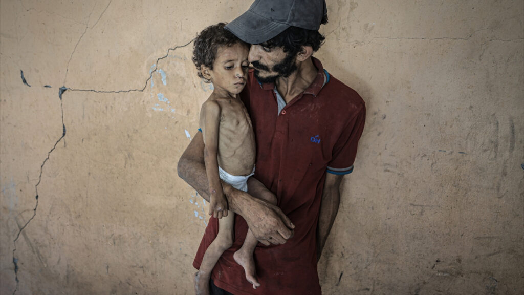 gazzede cocuklar aclikla mucadele ediyor 43pN8xHI