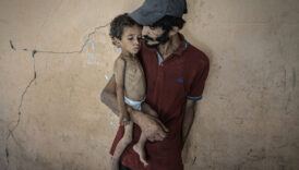 gazzede cocuklar aclikla mucadele ediyor 43pN8xHI