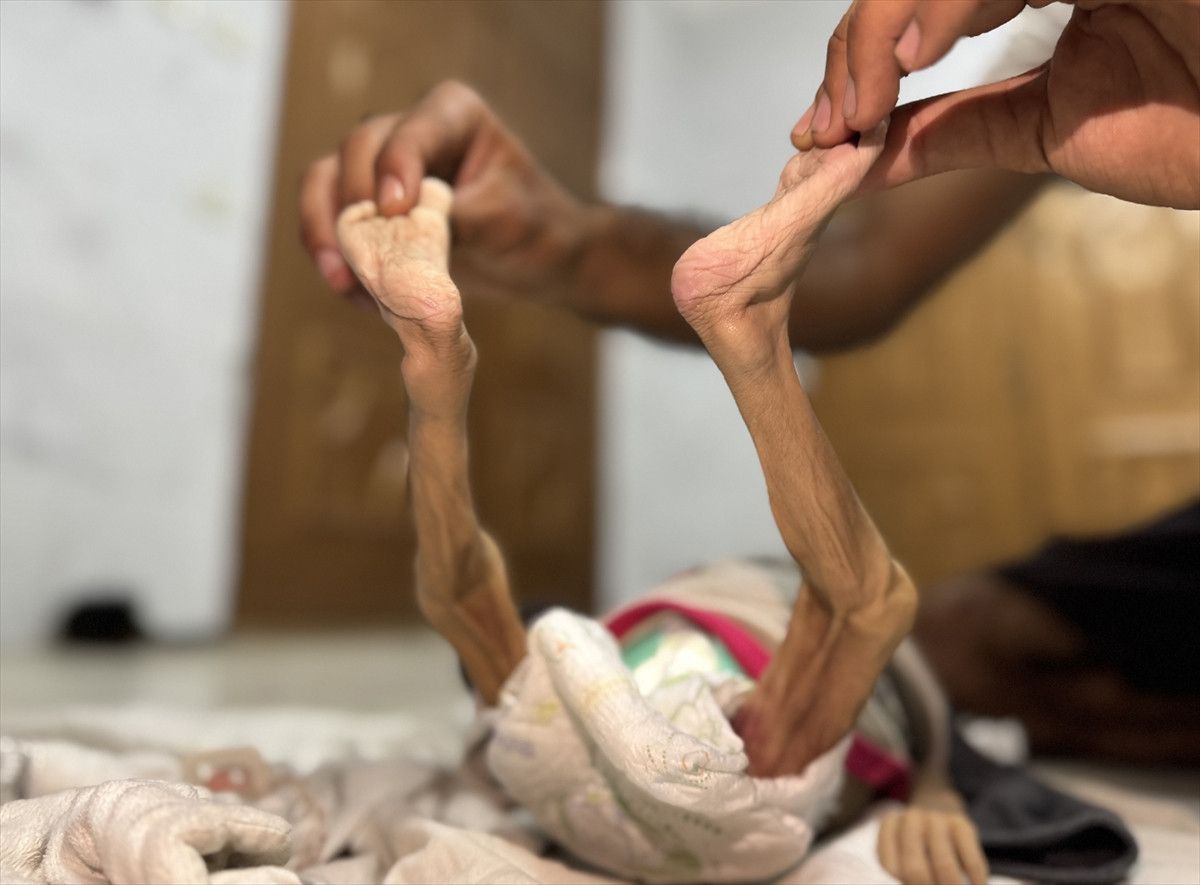 gazzede israil zulmu bir bebek daha acliktan hayatini kaybetti 0 79jU9LBL