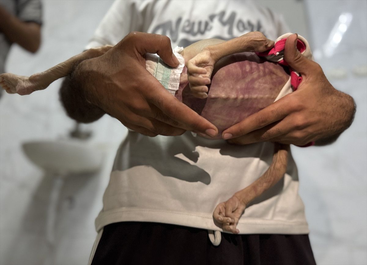 gazzede israil zulmu bir bebek daha acliktan hayatini kaybetti 2 KJ97N6tZ