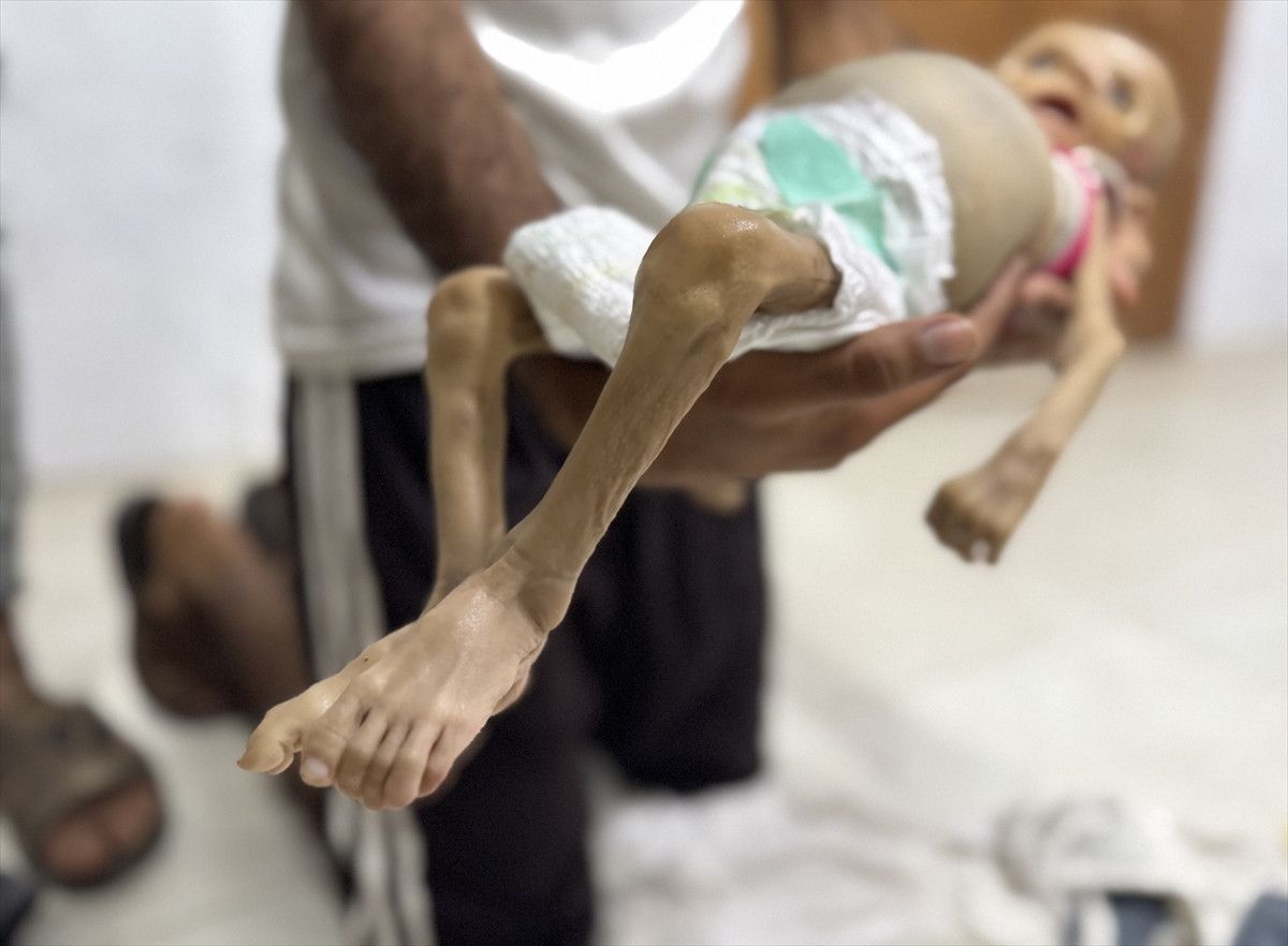 gazzede israil zulmu bir bebek daha acliktan hayatini kaybetti 3 Gkvy6IUh