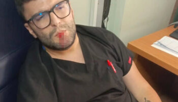 hatayda tansiyon olcme tartismasi hemsire darbedildi Iq4nA5O6