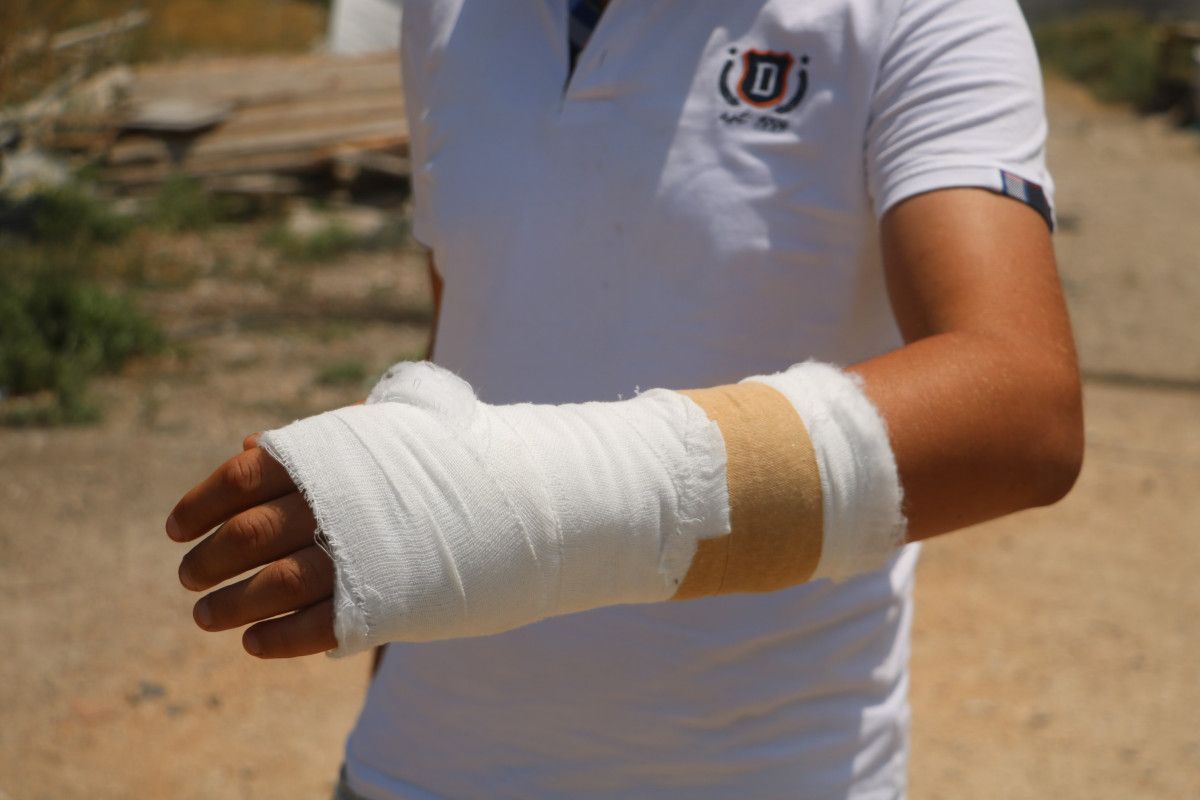 hatayda yangin evine sicramasin diye ugrasirken yamactan kopan kaya parcasi elini kirdi 3 neFeB6Fm