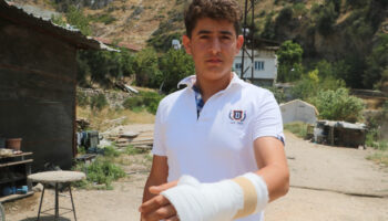 hatayda yangin evine sicramasin diye ugrasirken yamactan kopan kaya parcasi elini kirdi RRCgXqbn