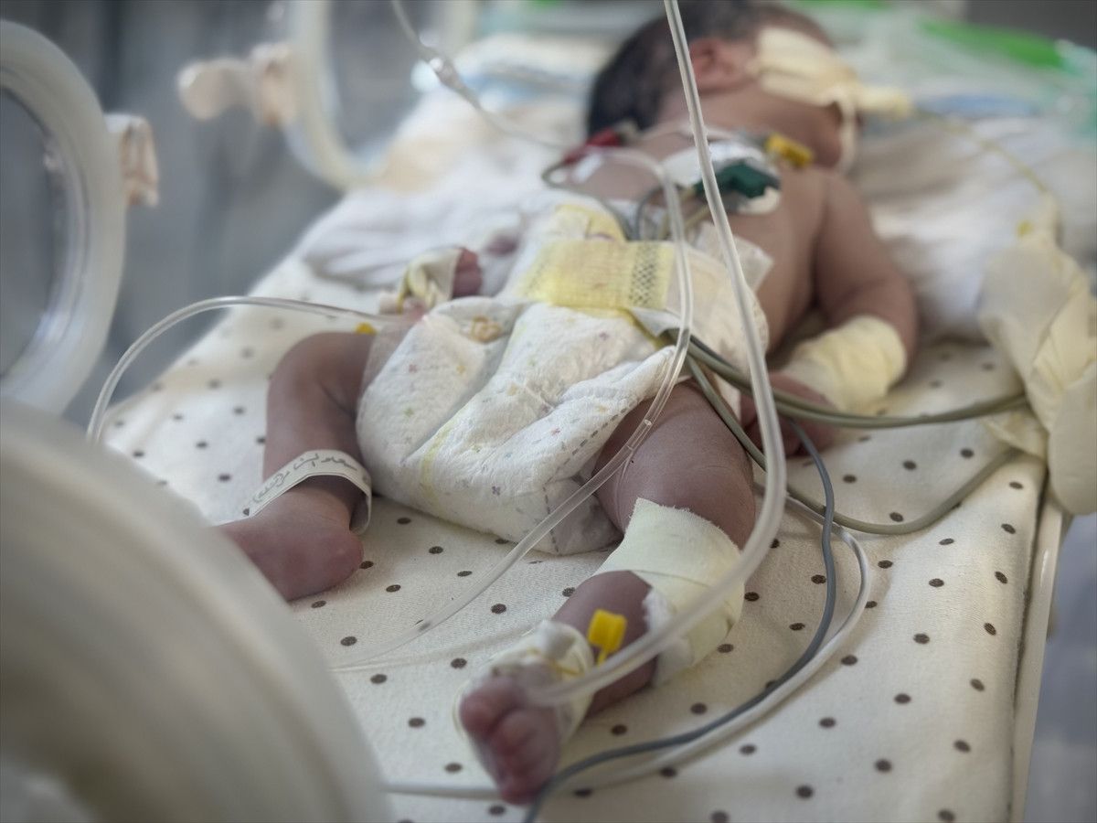 israil saldirisinda olen filistinli kadinin karnindaki bebek kurtarildi 0 RRwLXlYj